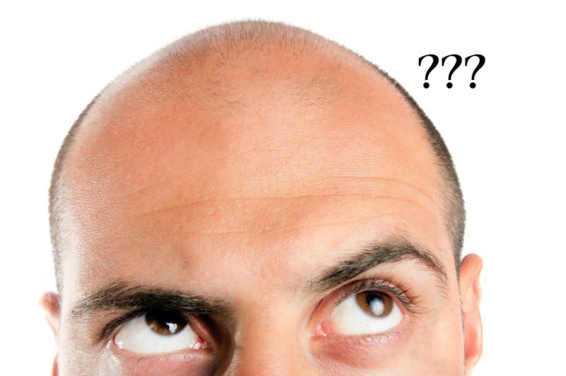 Cara Berkesan Mencegah Keguguran Rambut – Daily Rakyat