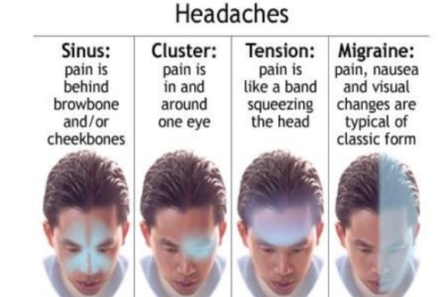 Hati-hati Dengan Sakit Kepala Yang Berterusan – Daily Rakyat