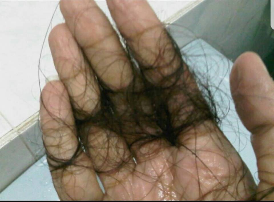 Lelaki Ini Kongsikan 5 Punca Keguguran Rambut Isteri Yang 