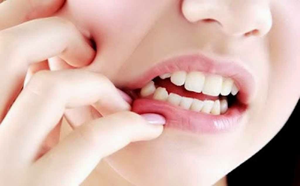 Sakit gigi mengganggu aktiviti seharian anda? Cuba 14 cara 
