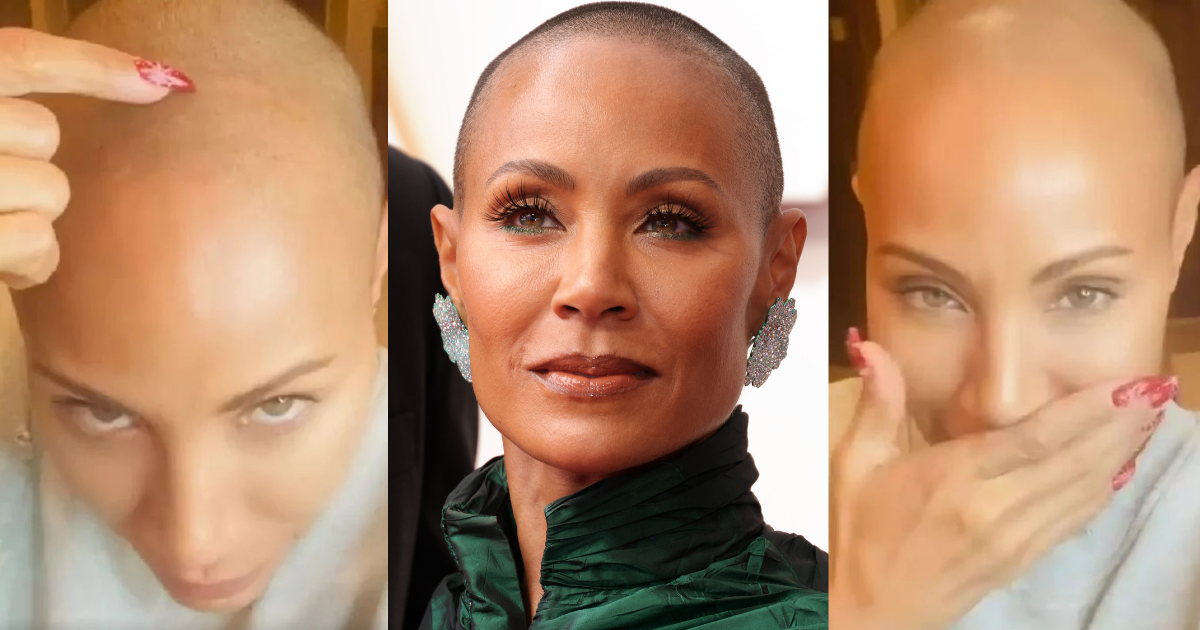 jada pinkett smith sudah alami alopecia sejak 2018